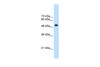 Antibody used in WB on Human HepG2 at 2.5 ug/ml.