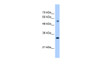 Antibody used in WB on Human HepG2 at 0.2-1 ug/ml.