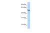 Antibody used in WB on Human HepG2 at 0.2-1 ug/ml.