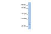 Antibody used in WB on Human HepG2 at 0.2-1 ug/ml.