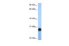 Antibody used in WB on Human HepG2 at 0.2-1 ug/ml.