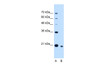 Antibody used in WB on Human HepG2 at 2.5 ug/ml.