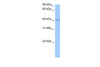 Antibody used in WB on Human Jurkat 0.2-1 ug/ml.