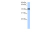 Antibody used in WB on Human MCF-7 at 0.2-1 ug/ml.