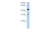 Antibody used in WB on Human HepG2 at 0.2-1 ug/ml.