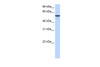 Antibody used in WB on Human Muscle at 0.2-1 ug/ml.