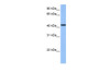 Antibody used in WB on Human HeLa at 0.2-1 ug/ml.