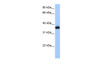 Antibody used in WB on Human Jurkat 0.2-1 ug/ml.