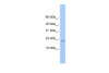 Antibody used in WB on Human 721_B at 0.2-1 ug/ml.