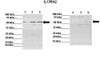 Antibody used in WB on mouse CT26, mouse MC38, human HCT116 at 1:1000 (Lane 1: 60ug mouse CT26 lysate Lane 2: 60ug mouse MC38 lysate Lane 3: 60ug human HCT116 lysate Lane 4: 60ug mouse CT26 lysate + blocking peptide Lane 5: 60ug mouse MC38 lysate + blocking peptide Lane 6: 60ug human HCT116 lysate + blocking peptide) .
