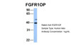 Antibody used in WB on Human Hela at 1 ug/ml.