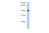 Antibody used in WB on Human Placenta at 0.2-1 ug/ml.