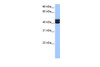 Antibody used in WB on Human Liver at 0.2-1 ug/ml.