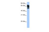 Antibody used in WB on Human Lung at 0.2-1 ug/ml.