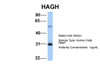 Antibody used in WB on Hum. Fetal Heart at 1 ug/ml.