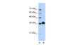 Antibody used in WB on Human Jurkat 0.625 ug/ml.