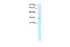 Antibody used in WB on Human Jurkat 1 ug/ml.