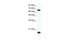 Antibody used in WB on Human Jurkat 1.25 ug/ml.