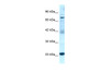 Antibody used in WB on Human Jurkat 0.2-1 ug/ml.