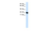 Antibody used in WB on Human Muscle at 0.2-1 ug/ml.