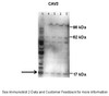 Antibody used in WB on Human placenta at: 1:500 (Lane1: 50 ug human placental tissue lysate, Lane2: 40 ug human placental tissue lysate, Lane3: 30 ug human placental tissue lysate, Lane4: 20 ug human placental tissue lysate, Lane5: 20 ug human myometrial tissue lysate) .