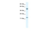 Antibody used in WB on Human Jurkat 0.2-1 ug/ml.