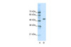 Antibody used in WB on Human Jurkat 0.0625 ug/ml.
