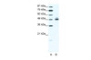 Antibody used in WB on Human HepG2 at 1.25 ug/ml.