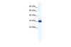 Antibody used in WB on Human HepG2 at 1.25 ug/ml.