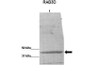 Antibody used in WB on BCAM0379 protein from B cenocepacia at 1:5000.