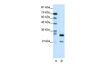 Antibody used in WB on Human Jurkat cells at 0.5 ug/ml (Lane A: Marker Lane, B: Jurkat cell lysates) .