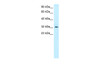 Antibody used in WB on Human Fetal Muscle at 0.6 ug/ml.