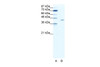 Antibody used in WB on Human HepG2 at 1.25 ug/ml.