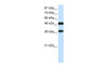 Antibody used in WB on Human 293T at 0.2-1 ug/ml.