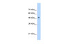 Antibody used in WB on Human Jurkat cells at 5.0 ug/ml.