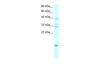 Antibody used in WB on Human Lung at 0.2-1 ug/ml.