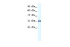 Antibody used in WB on Human Jurkat 1.25 ug/ml.