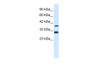 Antibody used in WB on Human HepG2 at 0.2-1 ug/ml.