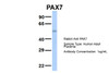 Antibody used in WB on Hum. Adult Placenta at 1 ug/ml.