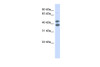 Antibody used in WB on Human Fetal Kidney at 1 ug/ml.