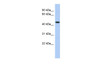 Antibody used in WB on Human kidney at 0.2-1 ug/ml.