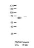 Antibody used in WB on human LCL, mouse brains at 1:1000.