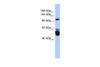 Antibody used in WB on Human Stomach at 0.2-1 ug/ml.