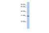 Antibody used in WB on Human HepG2 at 0.2-1 ug/ml.