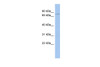 Antibody used in WB on Human HT1080 at 0.2-1 ug/ml.