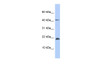 Antibody used in WB on Human Muscle at 0.2-1 ug/ml.