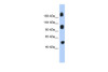 Antibody used in WB on Human Placenta at 0.2-1 ug/ml.