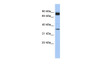 Antibody used in WB on Human Heart at 0.2-1 ug/ml.