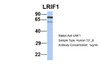 Antibody used in WB on Human 721_B at 1 ug/ml.
