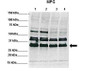Antibody used in WB on RCC4, 786-0 at 1:1000 (Lane1: 50ug RCC4 lysate, Lane2: 50ug RCC4 lysate, Lane3: 50ug 786-0 lysate, Lane4: 50ug 786-0 lysate) .